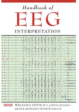 Handbook of EEG INTERPRETATION This Page Intentionally Left Blank Handbook of EEG INTERPRETATION
