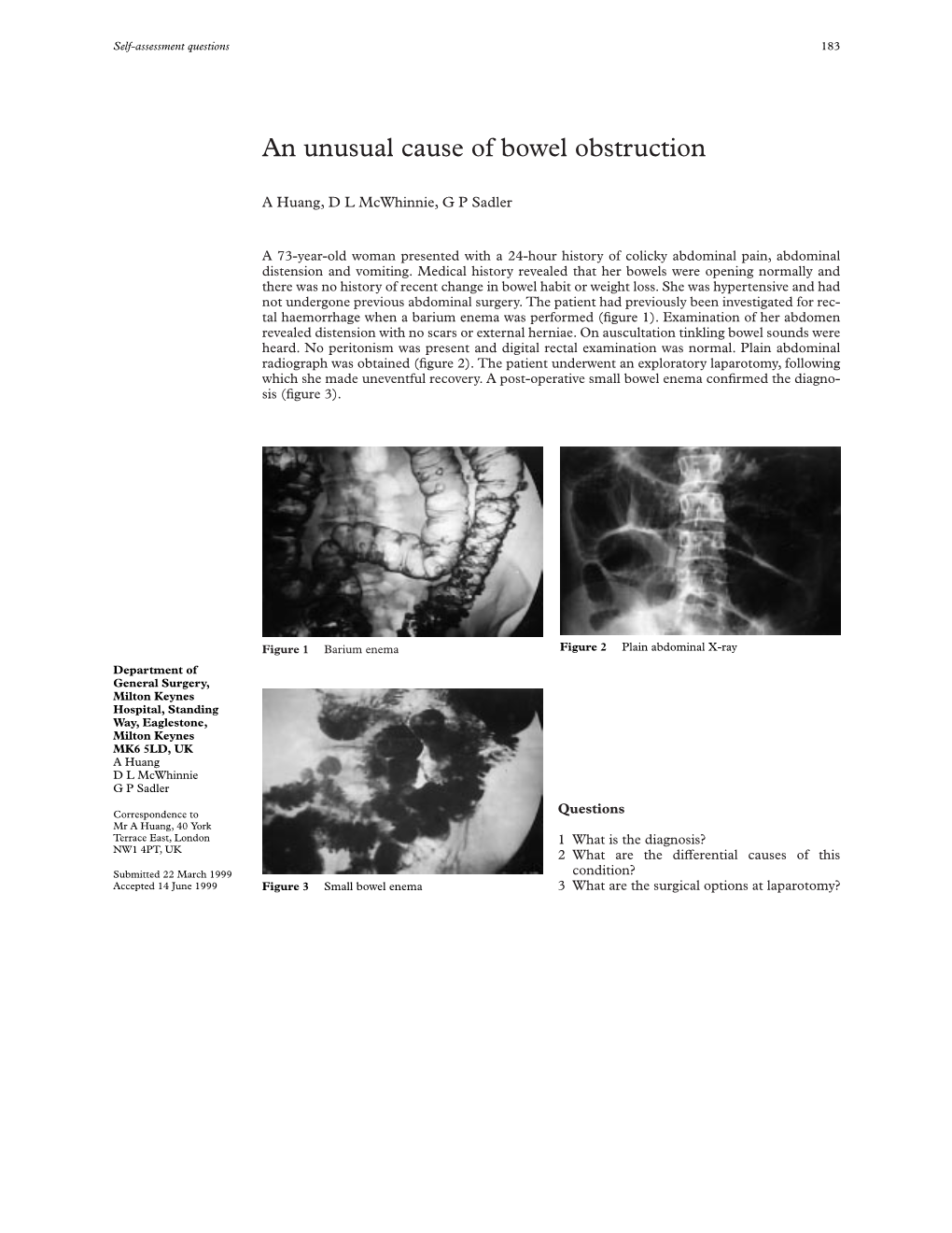 An Unusual Cause of Bowel Obstruction