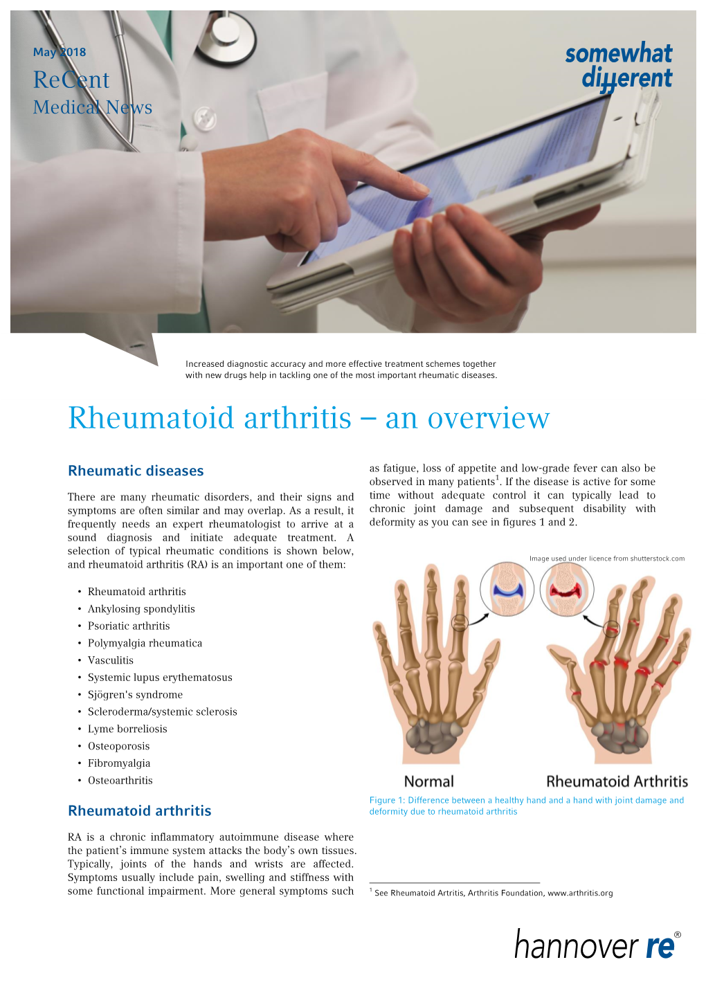 Rheumatoid Arthritis – an Overview