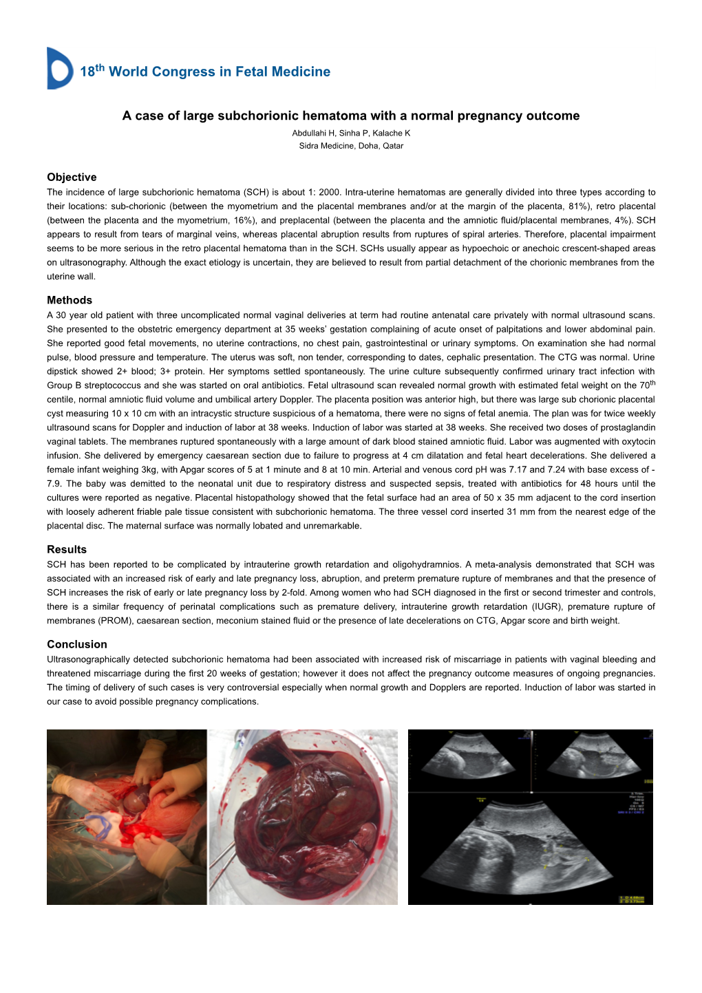 A Case of Large Subchorionic Hematoma with a Normal Pregnancy Outcome Abdullahi H, Sinha P, Kalache K Sidra Medicine, Doha, Qatar