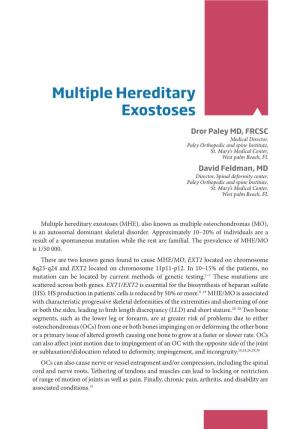 Multiple Hereditary Exostoses