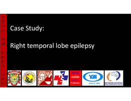 Case Study: Right Temporal Lobe Epilepsy