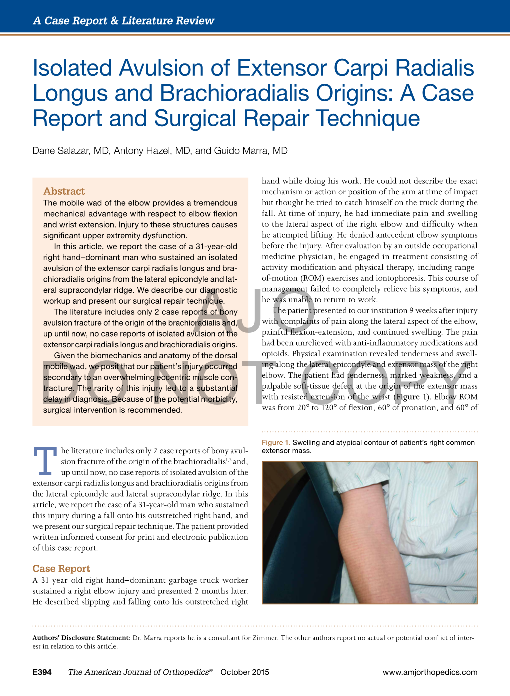 Isolated Avulsion of Extensor Carpi Radialis Longus and Brachioradialis Origins: a Case Report and Surgical Repair Technique