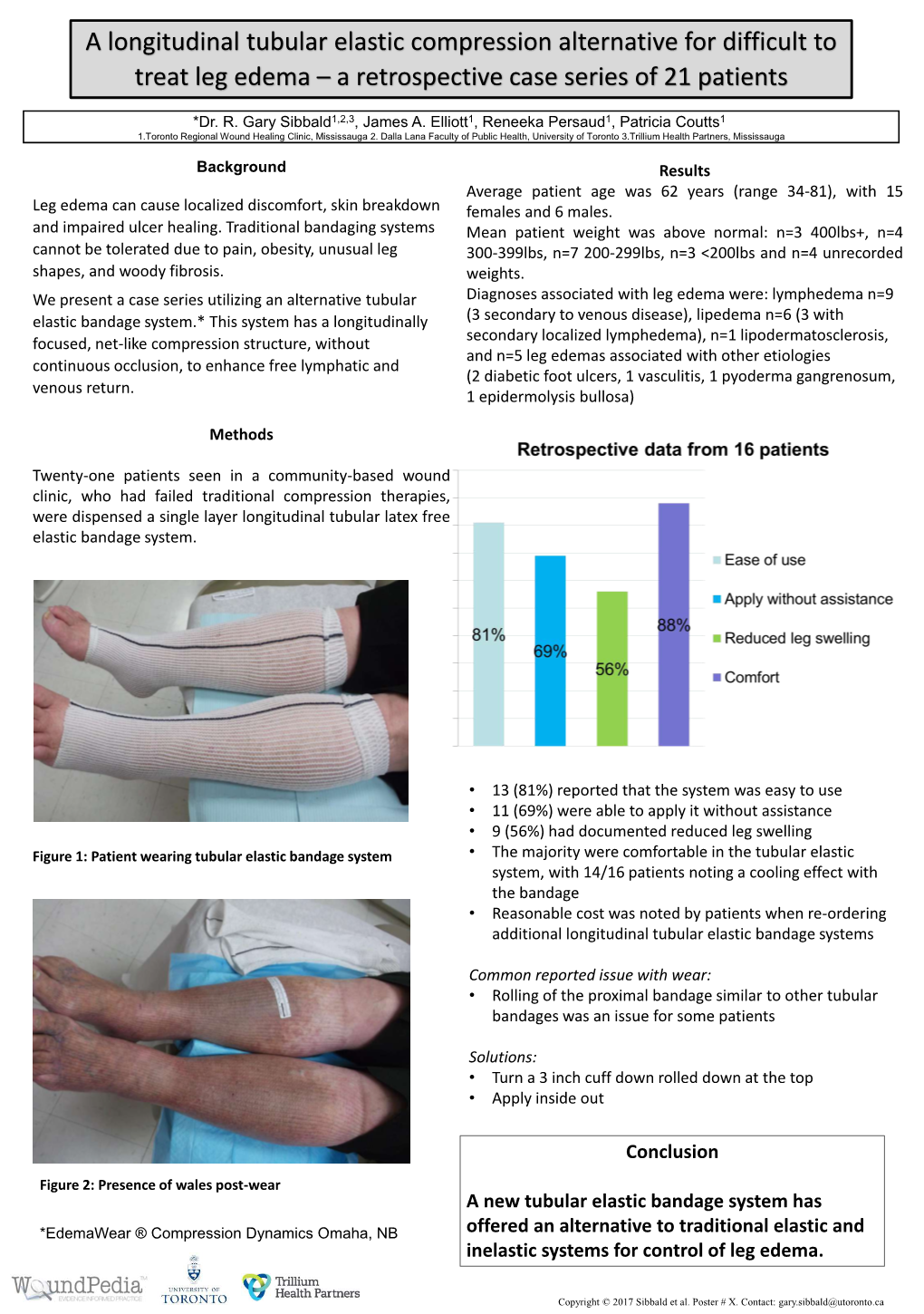 A Longitudinal Tubular Elastic Compression Alternative for Difficult to Treat Leg Edema – a Retrospective Case Series of 21 Patients