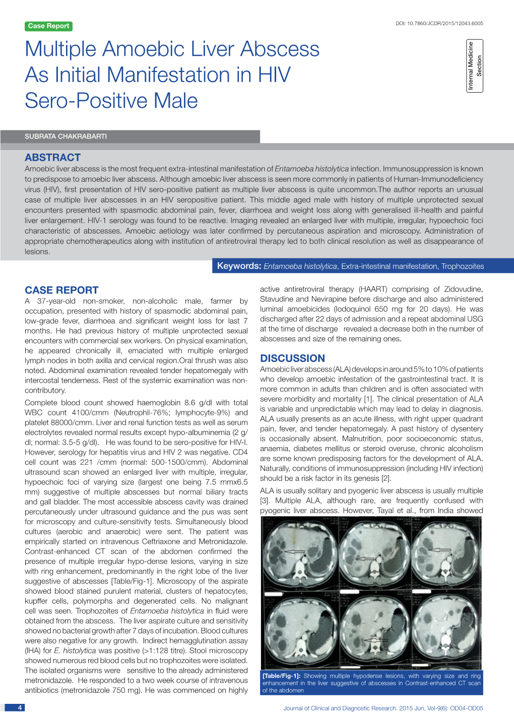 Multiple Amoebic Liver Abscess As Initial Manifestation in Hiv Sero-Positive Male