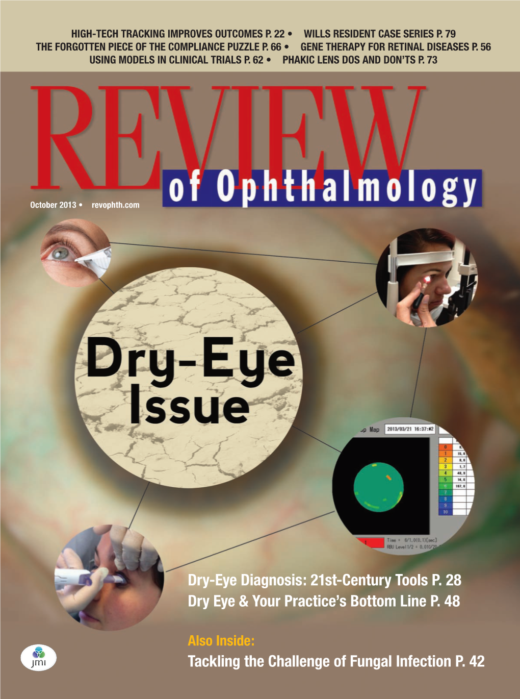 Dry-Eye Diagnosis: 21St-Century Tools P