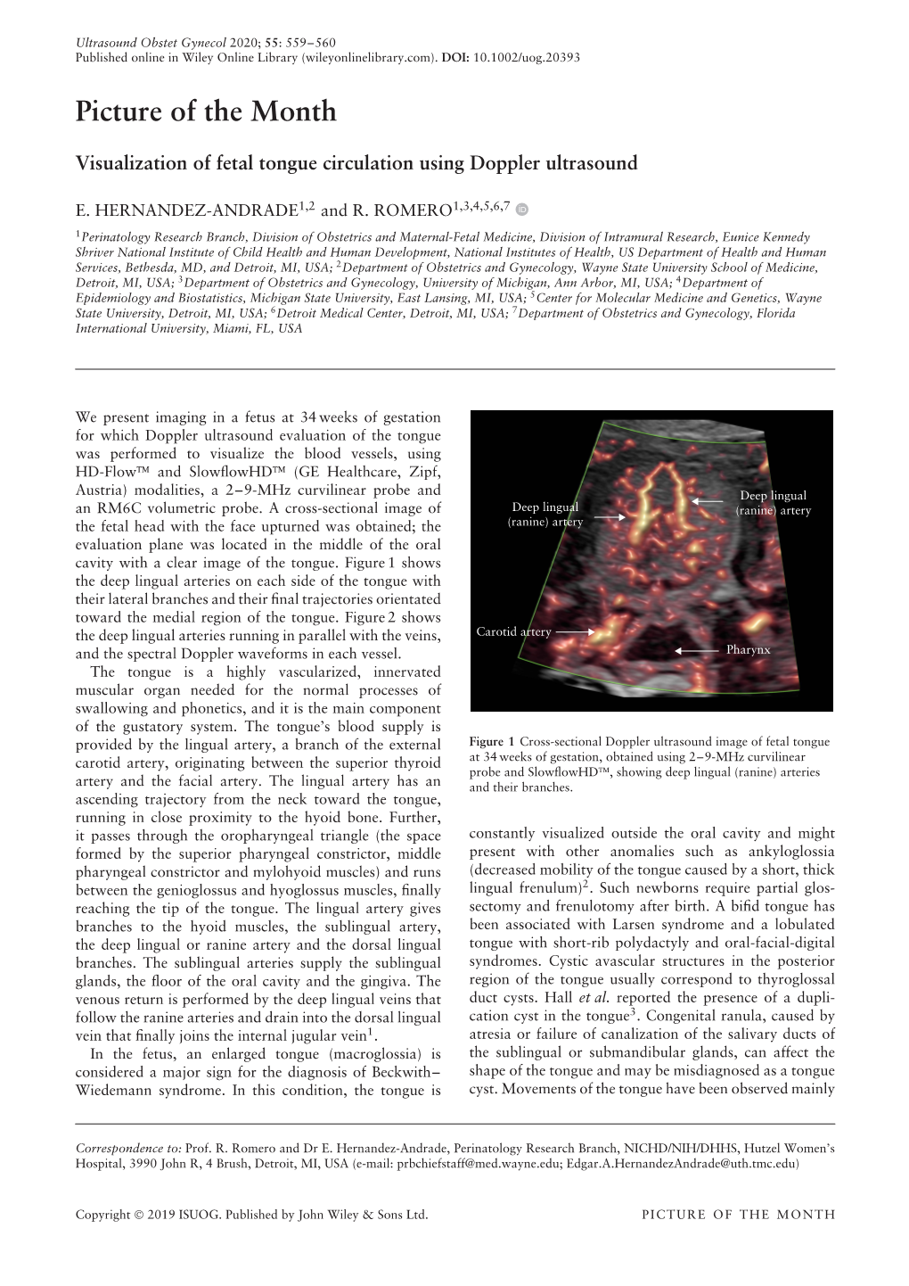 Visualization of Fetal Tongue Circulation Using Doppler Ultrasound