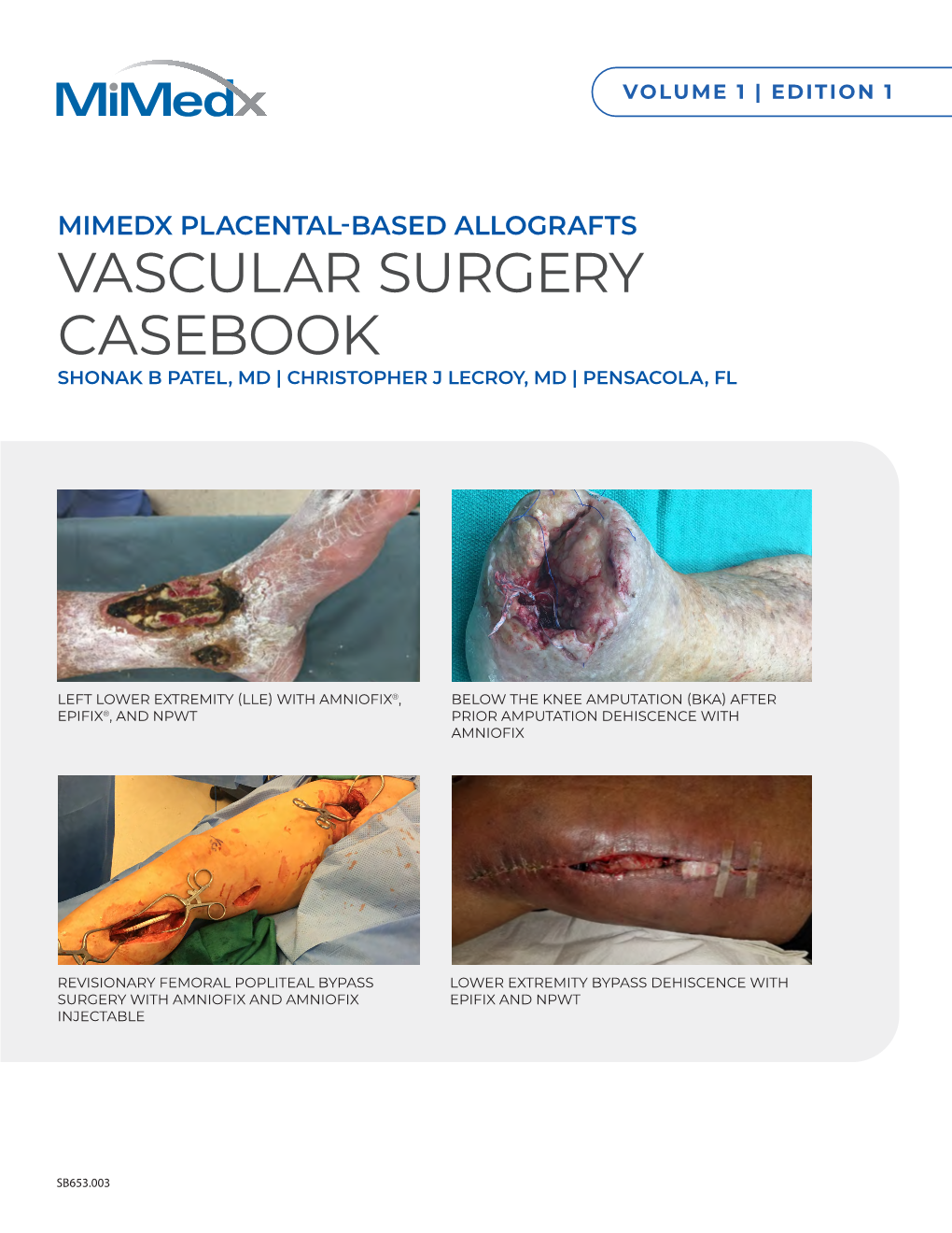 Vascular Surgery Casebook Shonak B Patel, Md | Christopher J Lecroy, Md | Pensacola, Fl