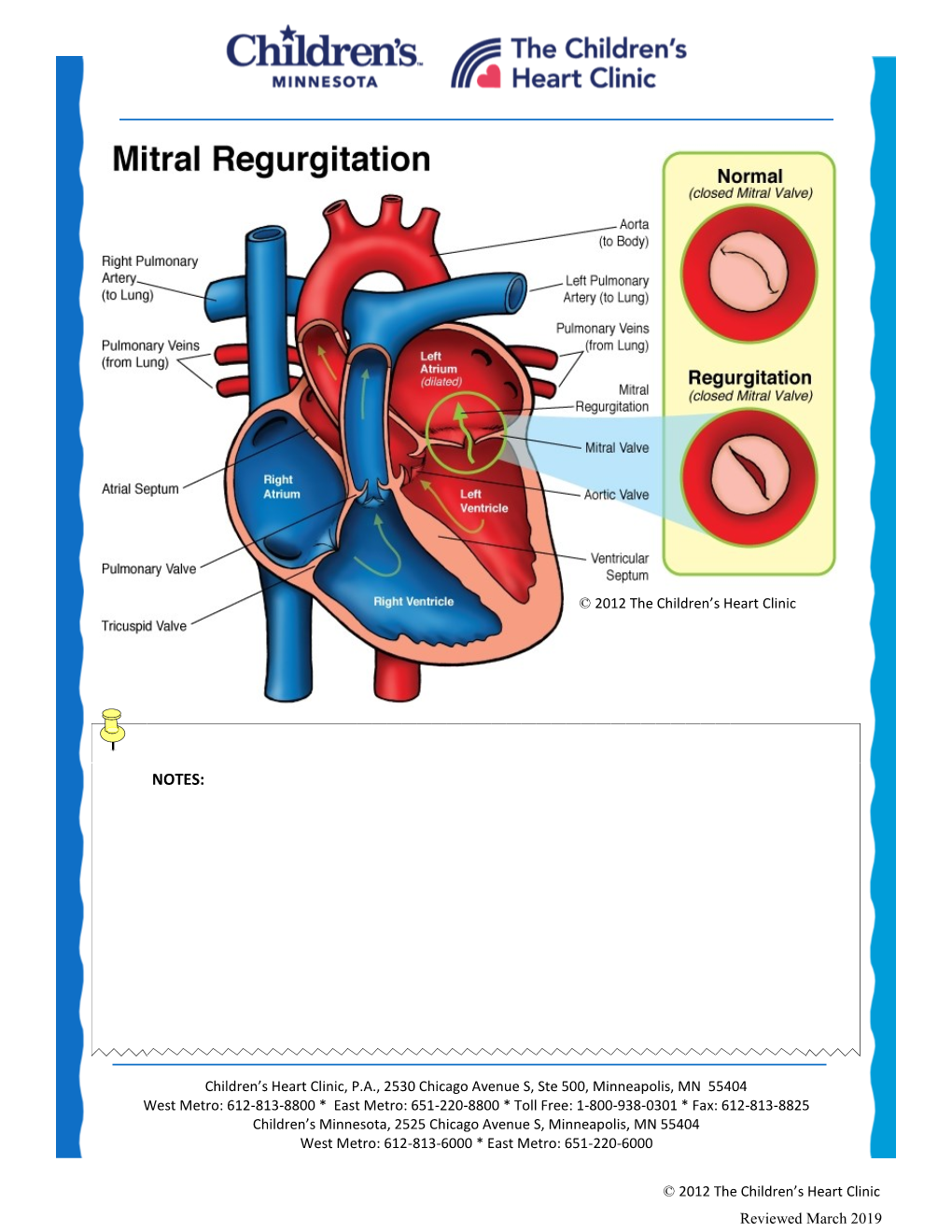 Mitral Regurgitation (MR)