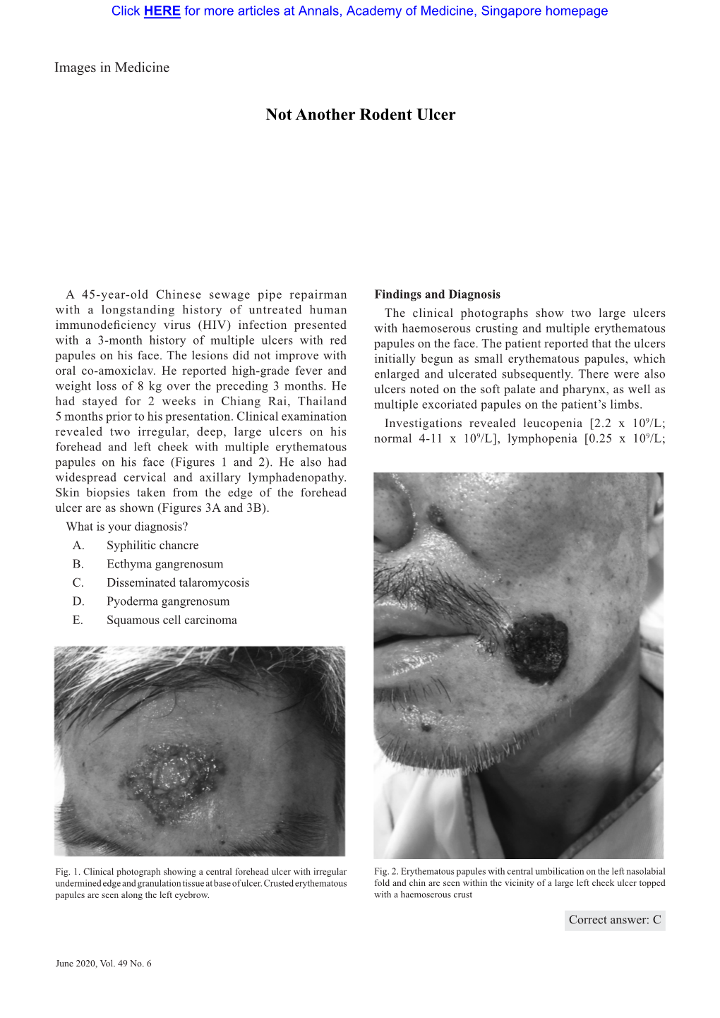 Not Another Rodent Ulcer—Xiaotian Wu Et Al 417 Images in Medicine