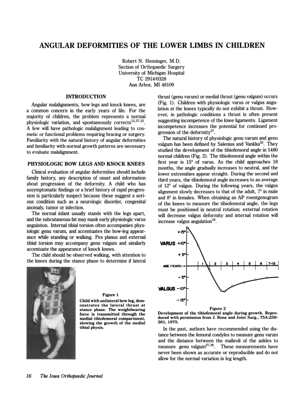 Angular Deformities of the Lower Limbs in Children