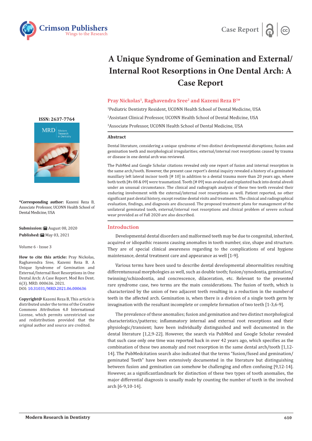 A Unique Syndrome of Gemination and External/ Internal Root Resorptions in One Dental Arch: a Case Report