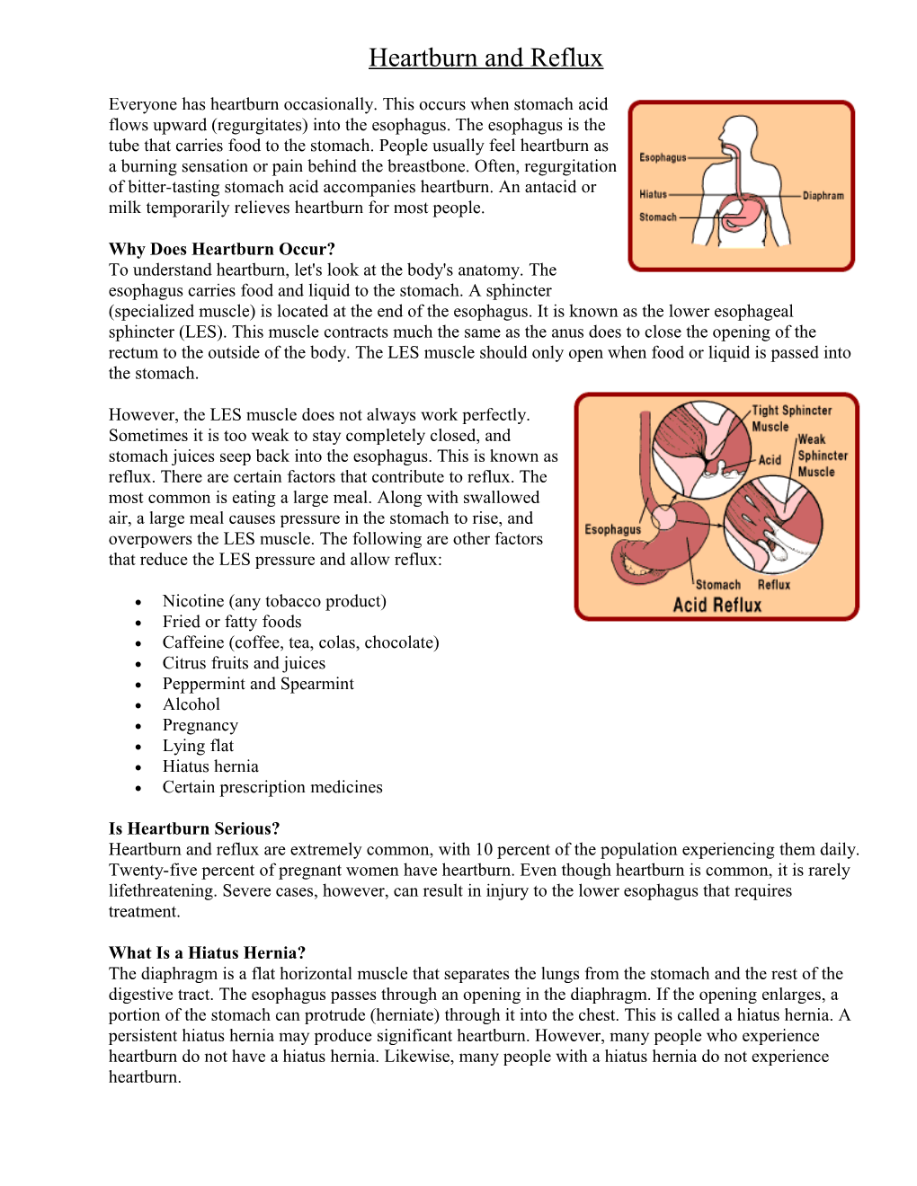 Heartburn and Reflux