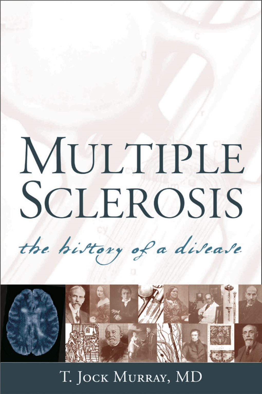 Multiple Sclerosis: the History of a Disease Murray 00 11/10/04 10:58 AM Page Ii Murray 00 11/10/04 10:58 AM Page Iii