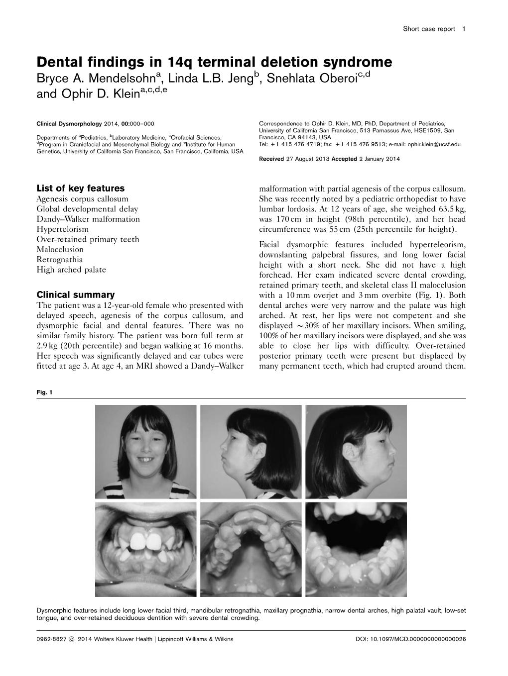 Dental Findings in 14Q Terminal Deletion Syndrome Bryce A