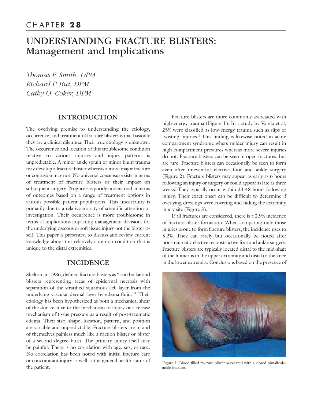 UNDERSTANDING FRACTURE BLISTERS: Management and Implications