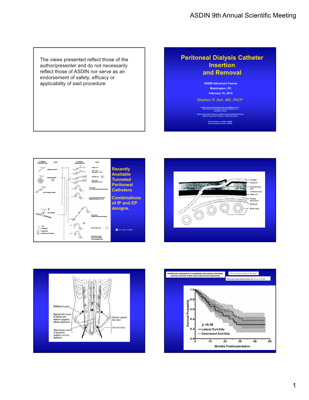 Peritoneal Dialysis Catheter Insertion and Removal