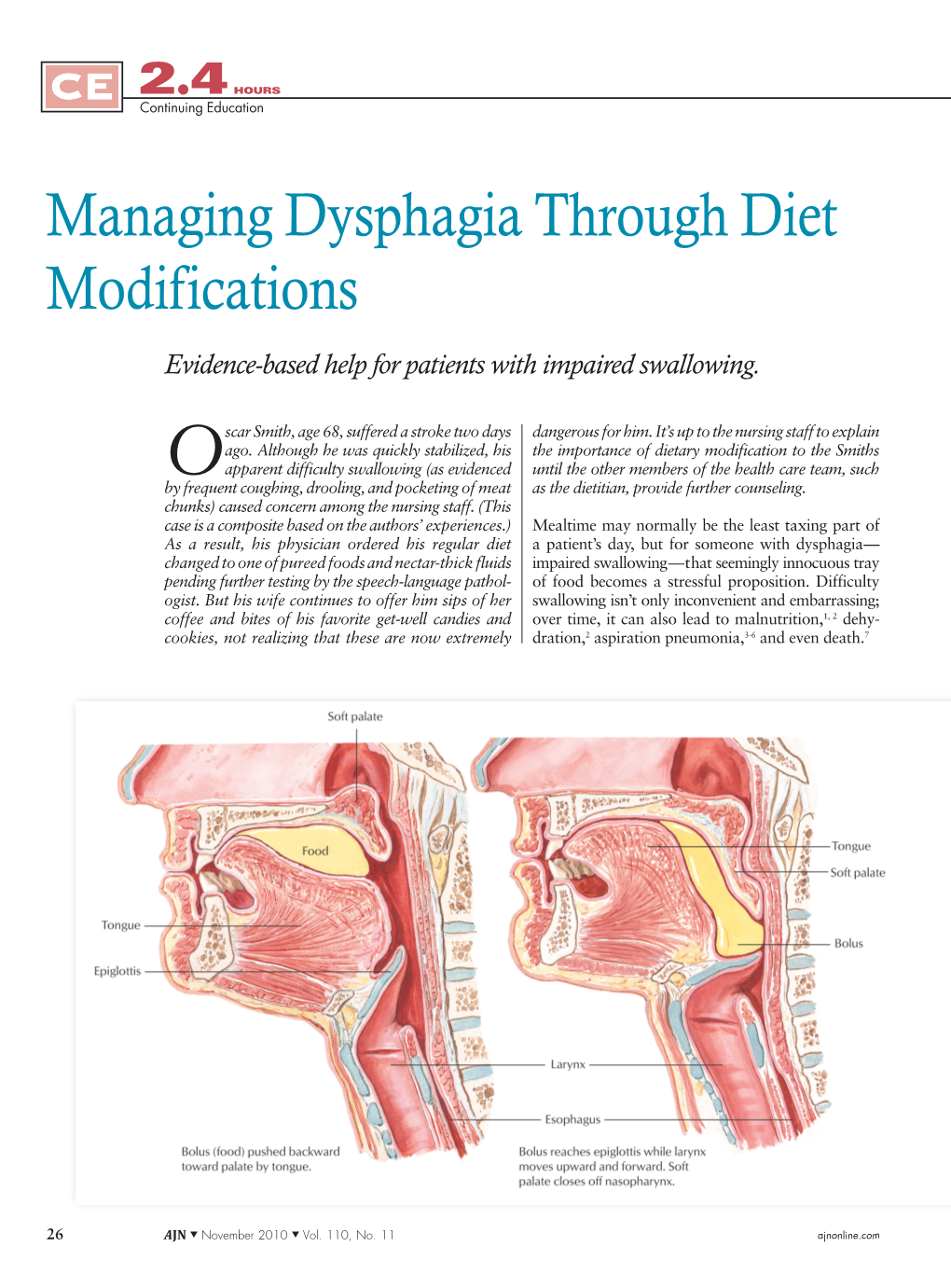 Managing Dysphagia Through Diet Modifications