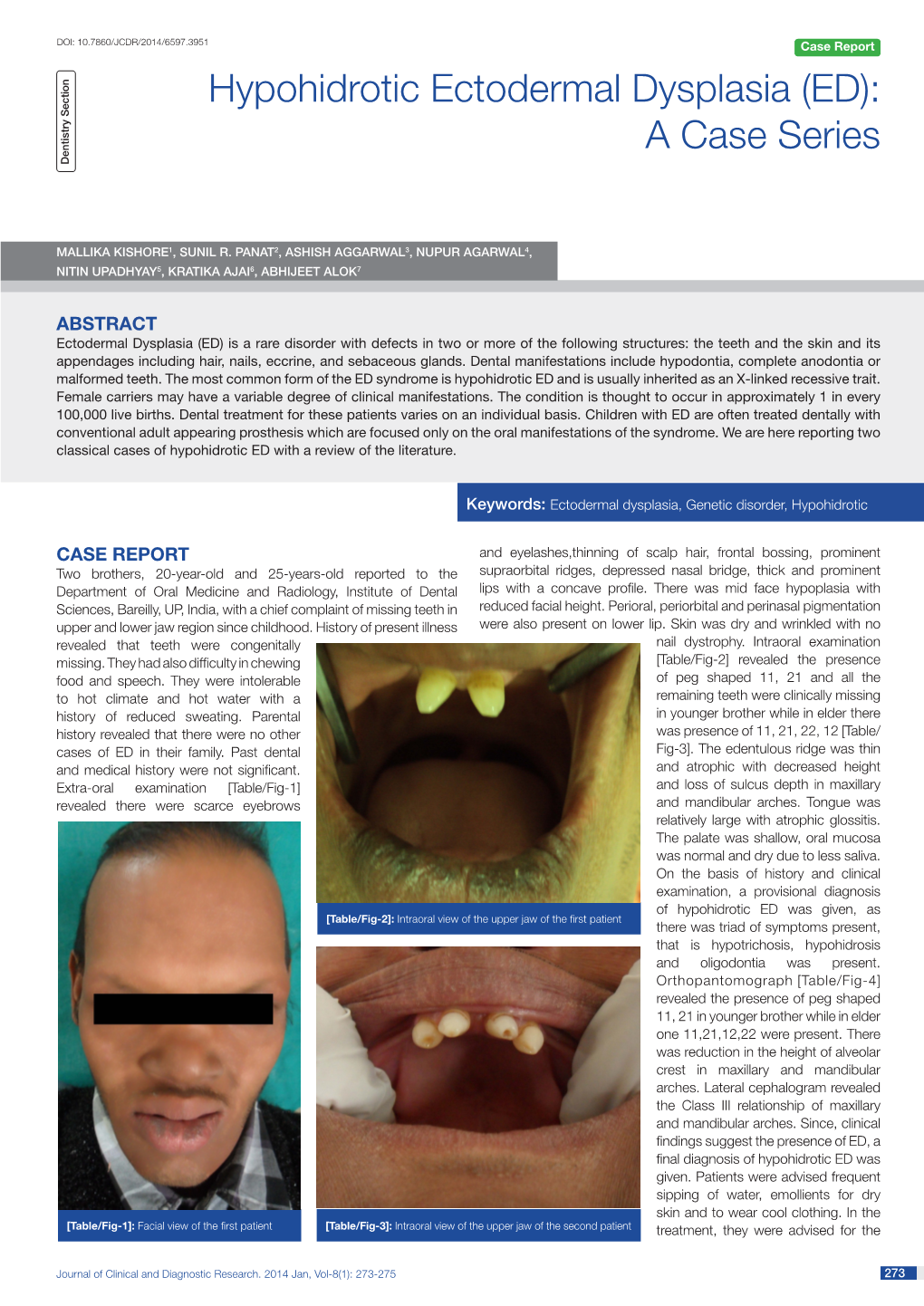 Hypohidrotic Ectodermal Dysplasia (ED): a Case Series Dentistry Section