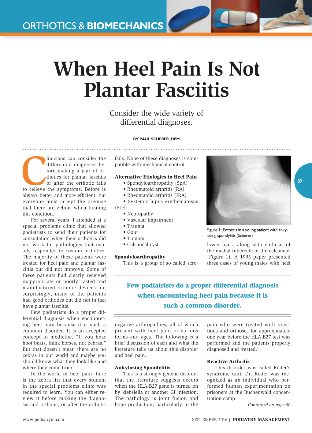 When Heel Pain Is Not Plantar Fasciitis