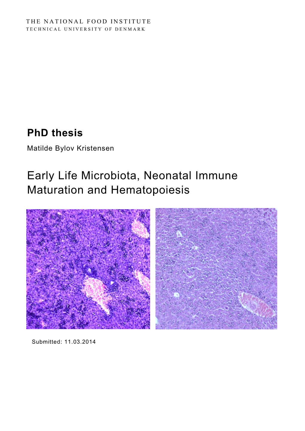 Early Life Microbiota, Neonatal Immune Maturation and Hematopoiesis