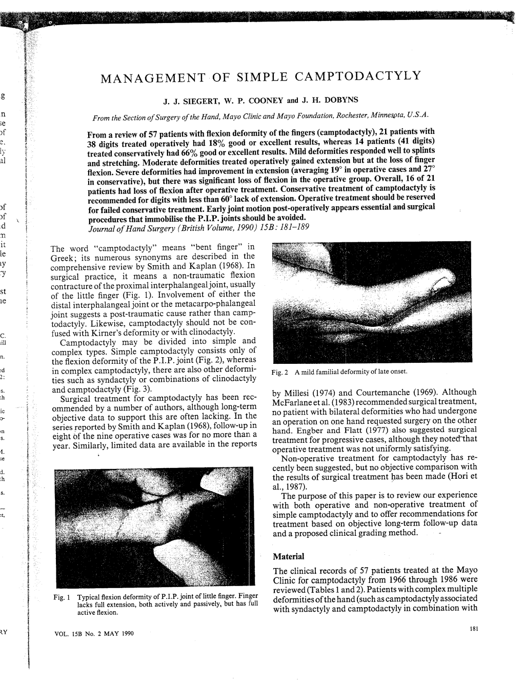 Management of Simple Camptodactyly