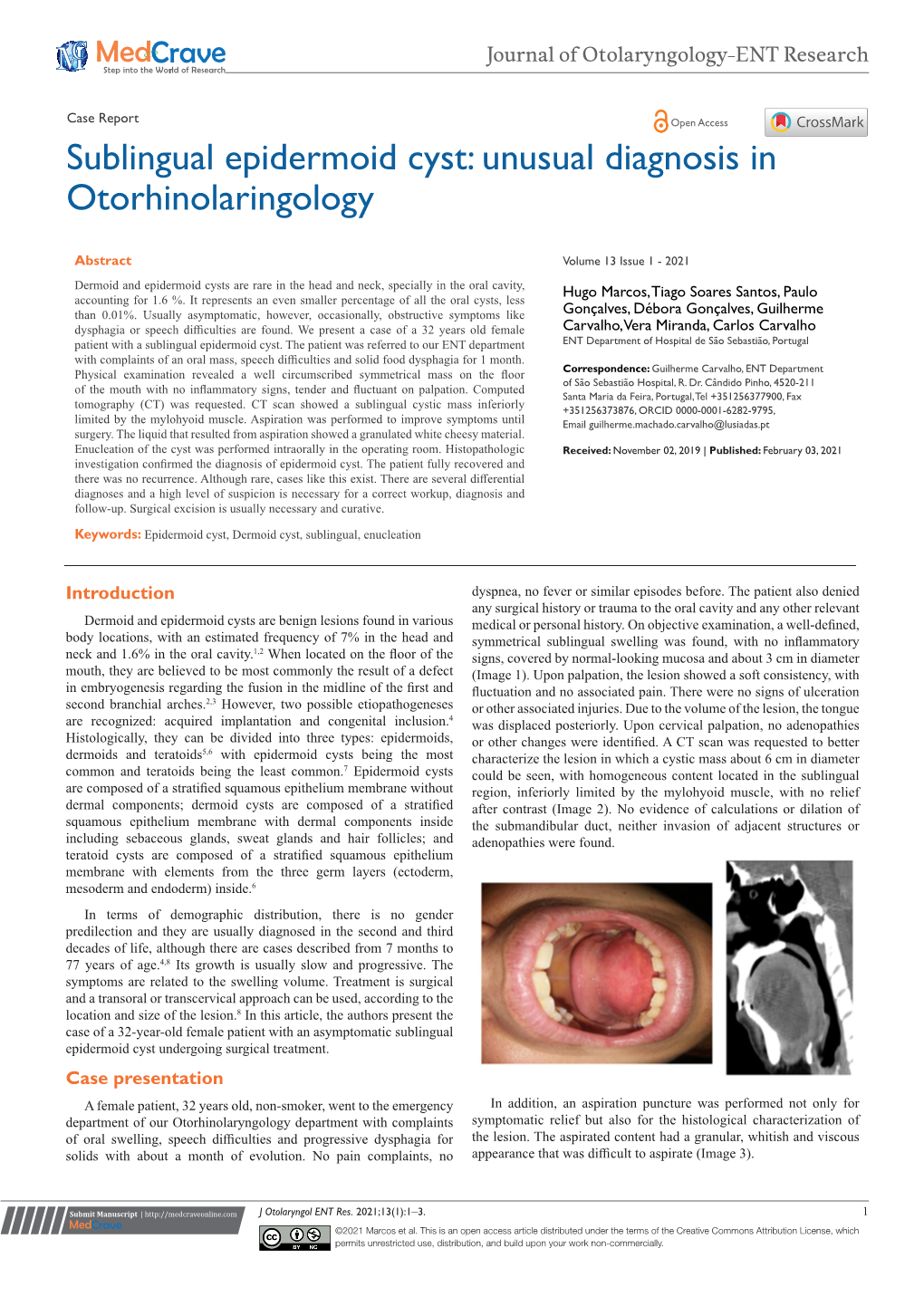 Sublingual Epidermoid Cyst: Unusual Diagnosis in Otorhinolaringology