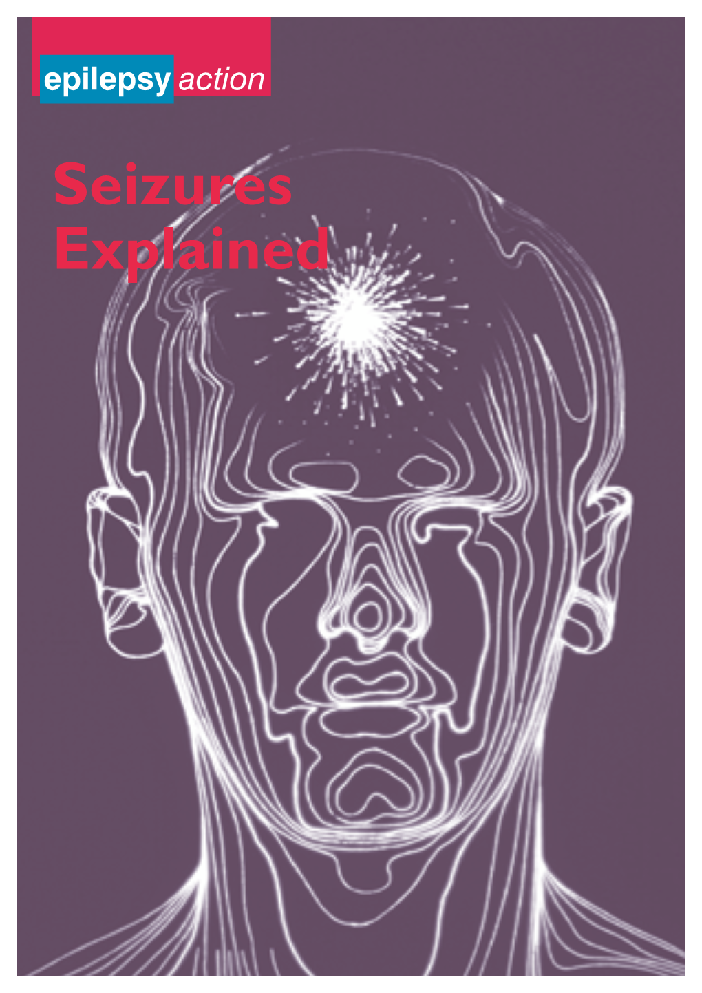 Seizures Explained