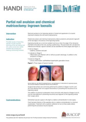 Partial Nail Avulsion and Chemical Matricectomy: Ingrown Toenails