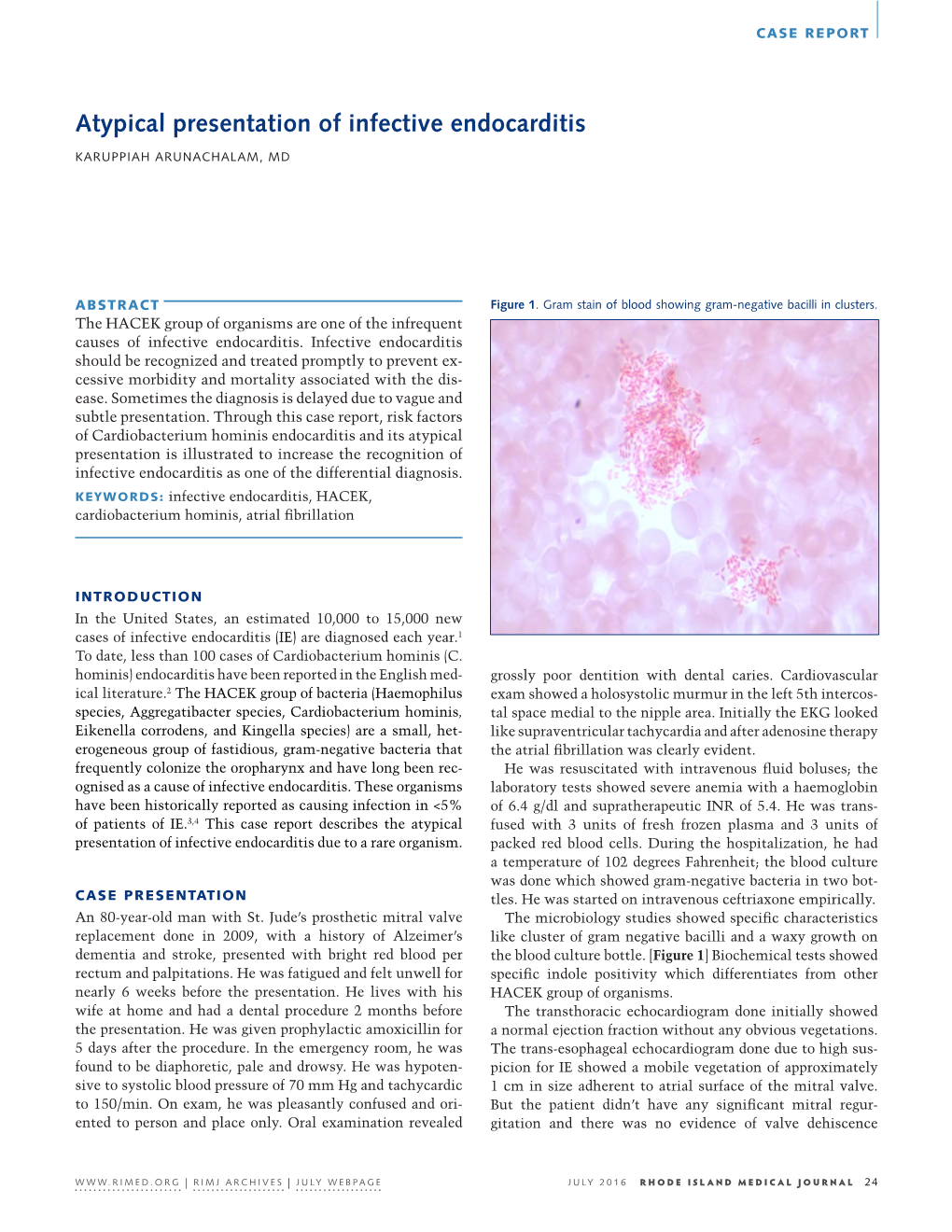 Atypical Presentation of Infective Endocarditis