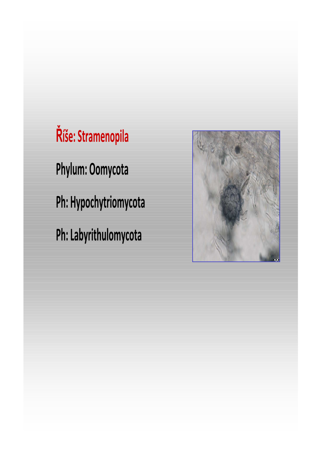 Říše: Stramenopila Phylum: Oomycota Ph: Hypochytriomycota Ph: Labyrithulomycota Phyllumphyllum :: Oomycotaoomycota