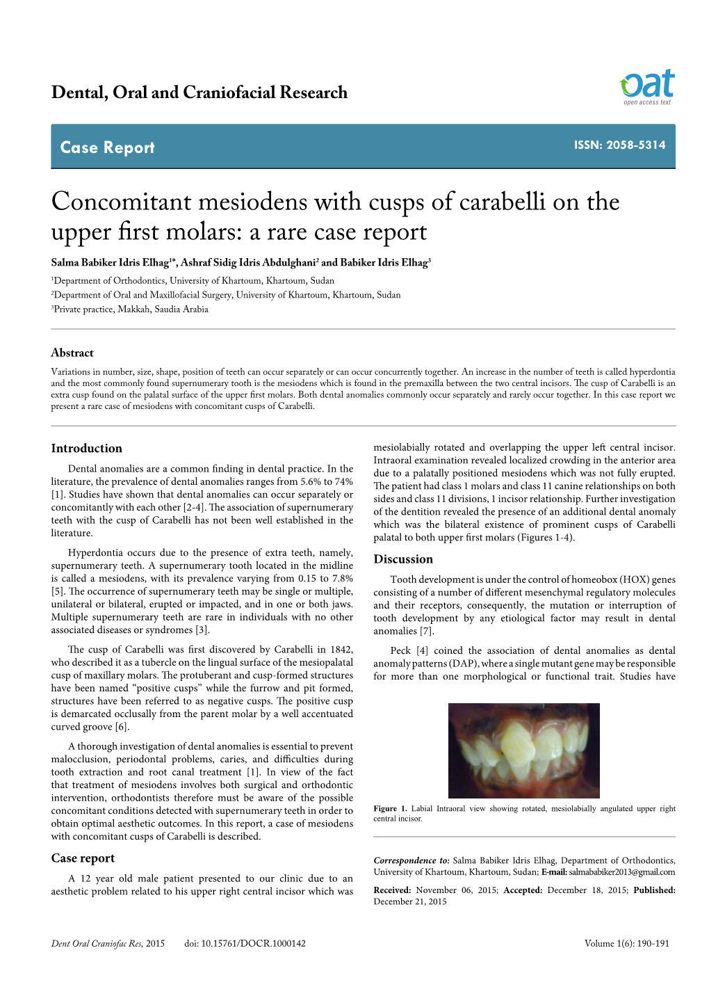 Concomitant Mesiodens with Cusps of Carabelli on The