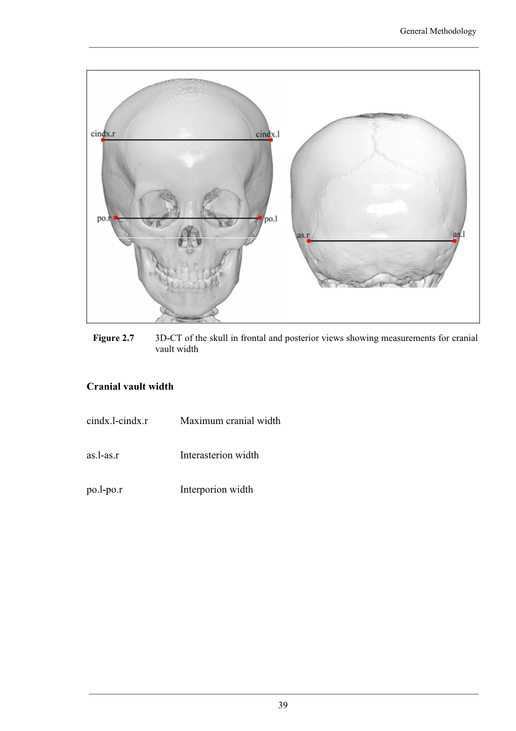 Figure 2.7 3D-CT of the Skull in Frontal and Posterior Views Showing Measurements for Cranial Vault Width