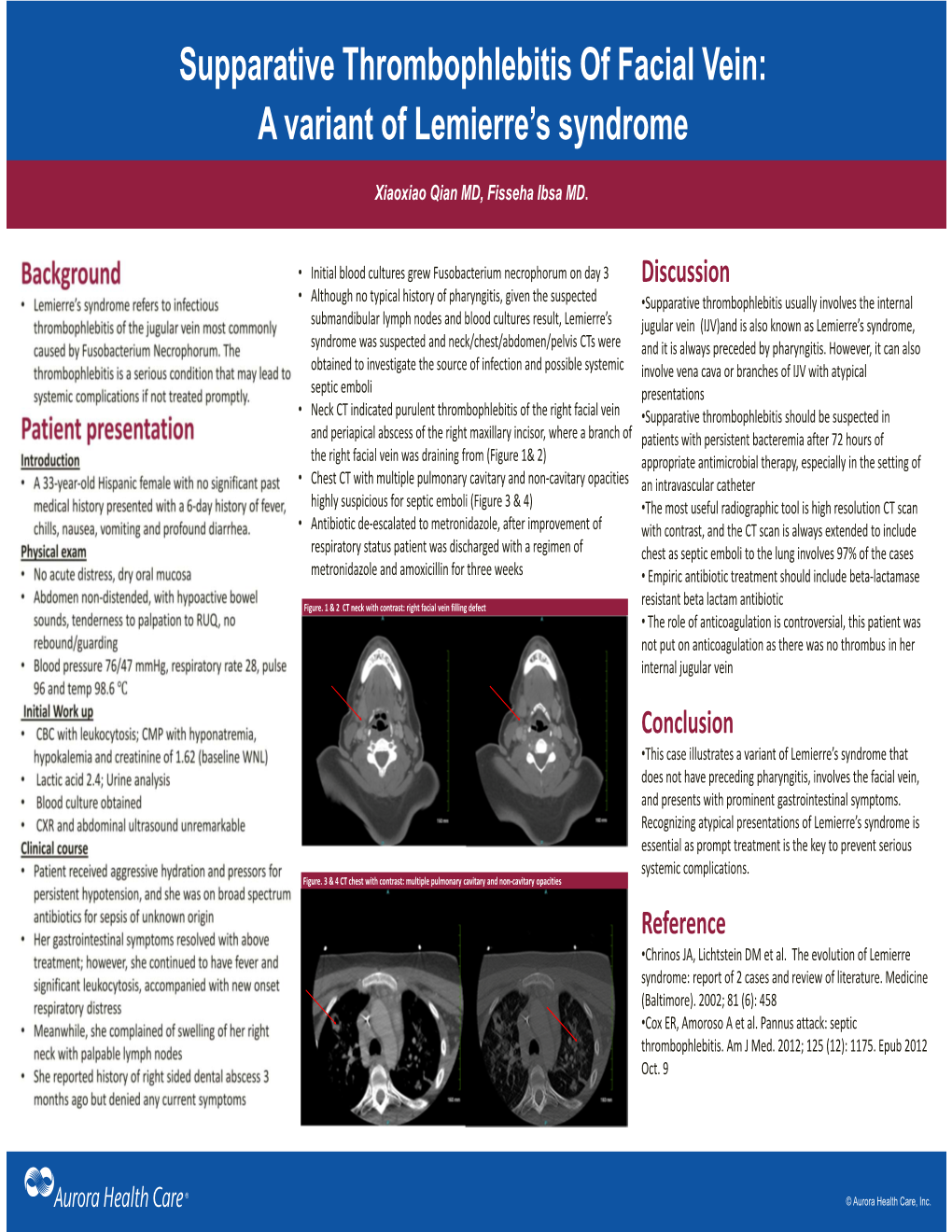 Supparative Thrombophlebitis of Facial Vein: a Variant of Lemierre's