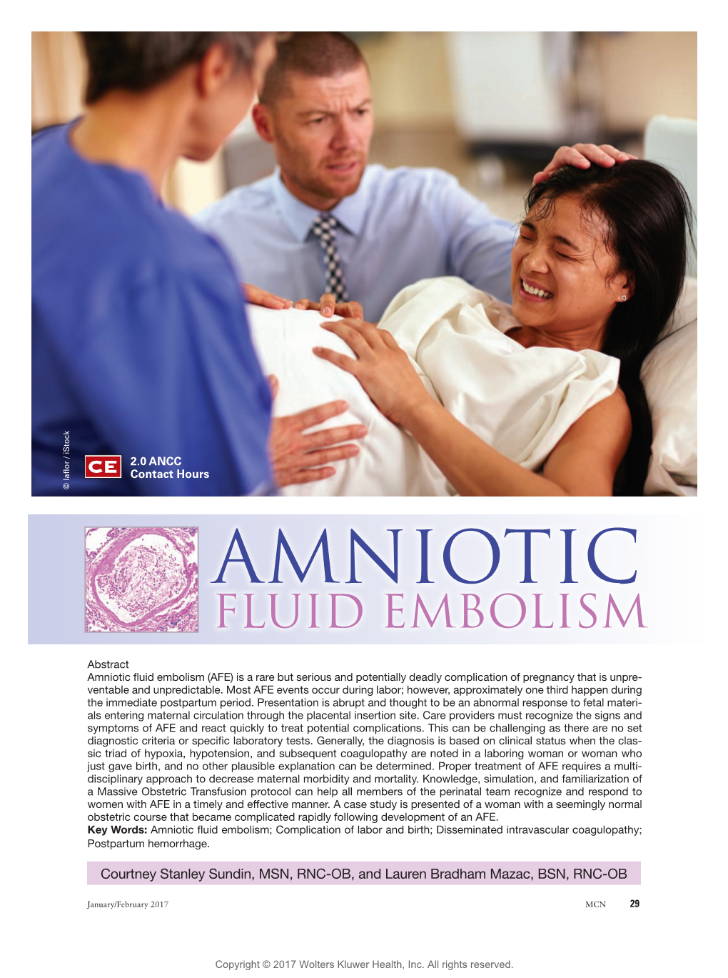 amniotic fluid embolism statistics