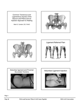 Iliolumbar Ligament Referred Pain