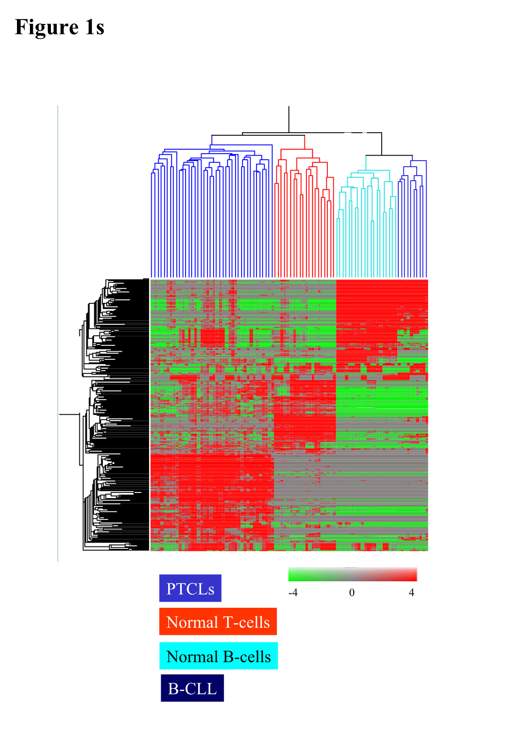 Gene Expression Analysis of Peripheral T-Cell Lymphoma