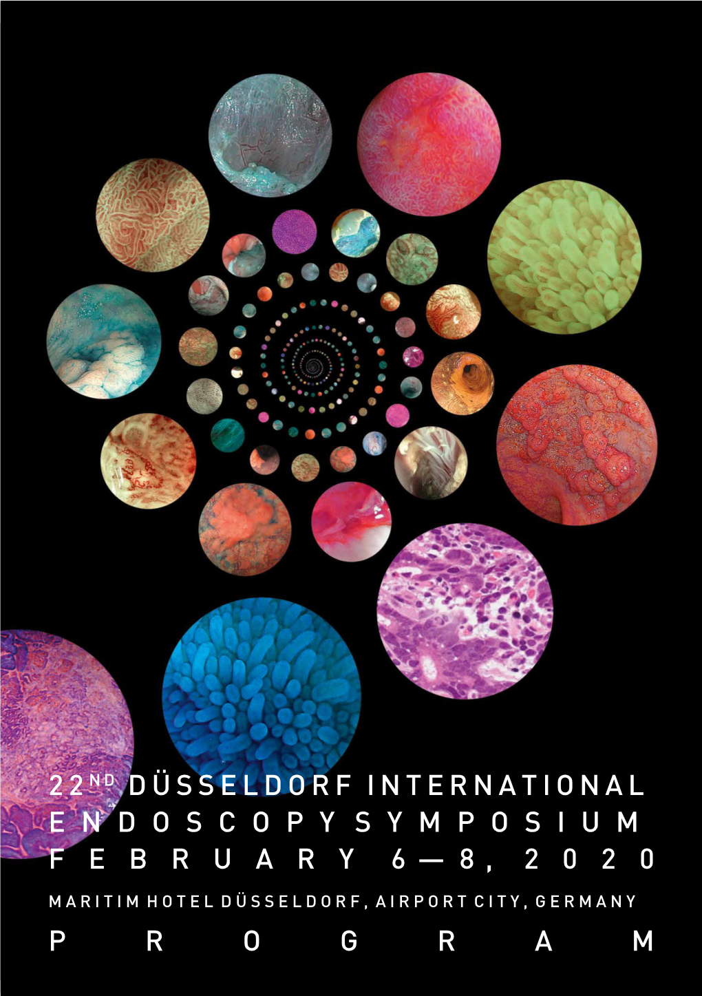 22N D Düsseldorf International Endoscopysymposium February 6