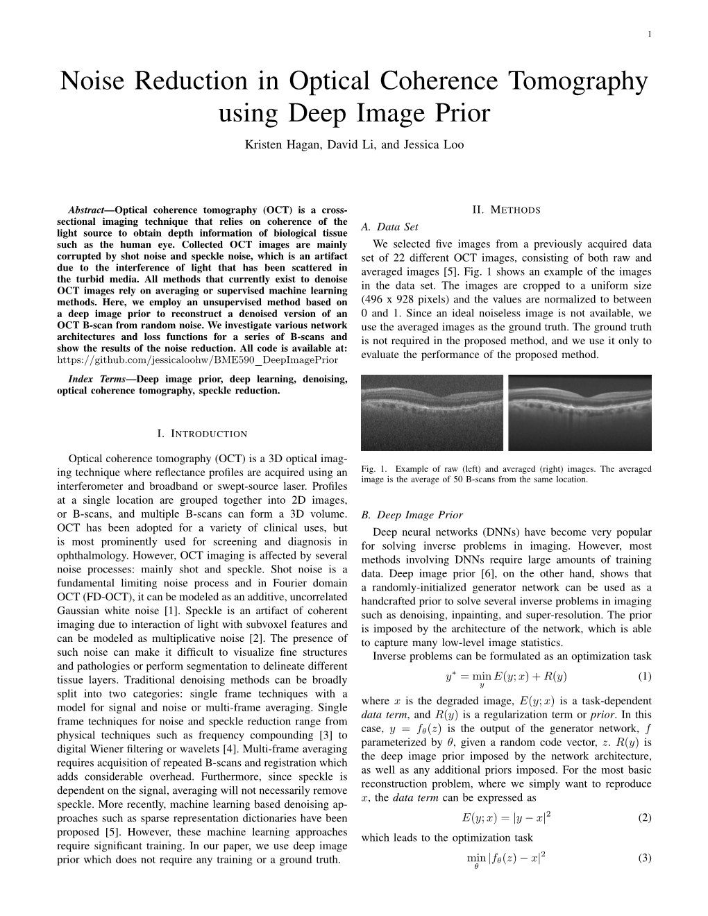 Noise Reduction in Optical Coherence Tomography Using Deep Image Prior Kristen Hagan, David Li, and Jessica Loo