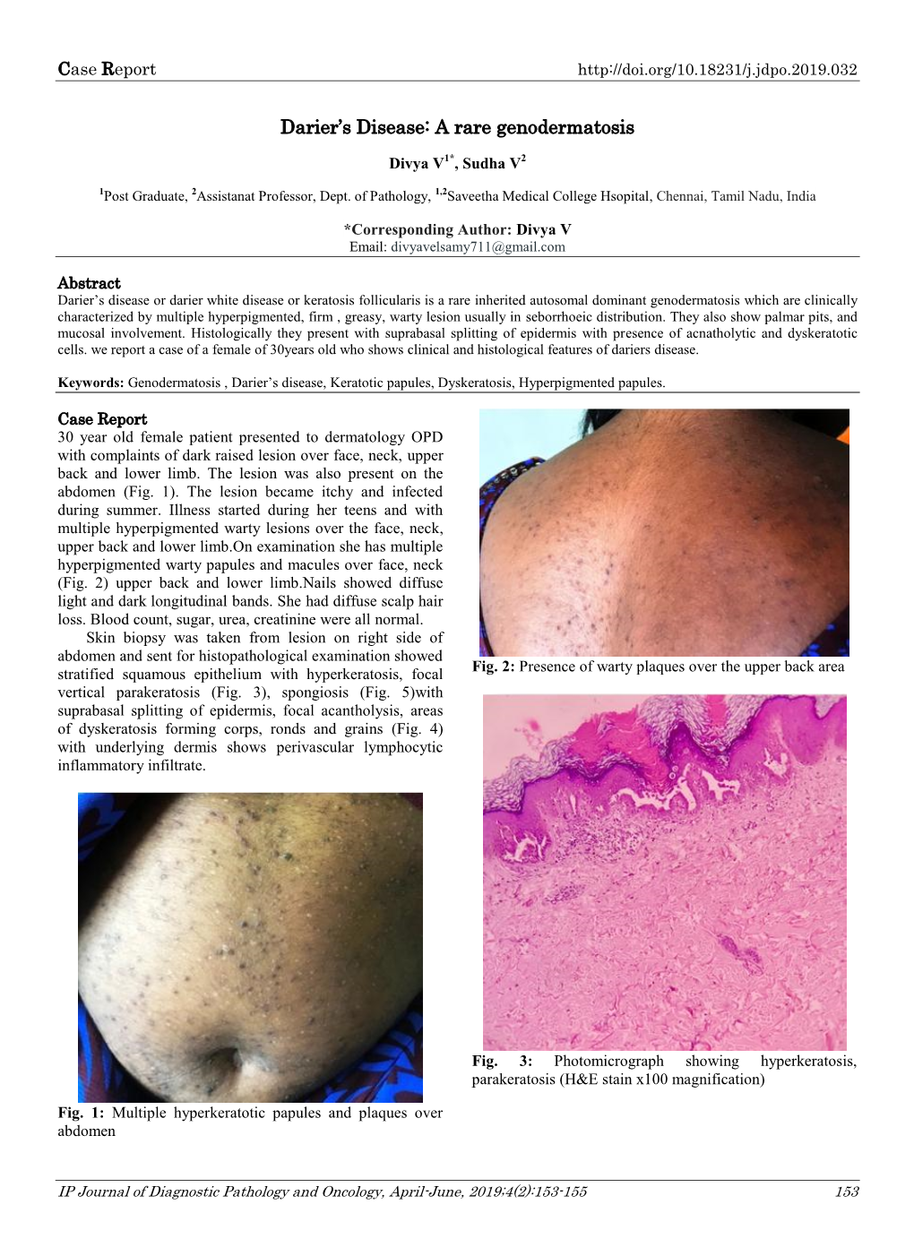 Darier's Disease Maps to Premature Keratinization, Presence of Villi, Corps, Ronds and Chromosome12q23-Q24.1