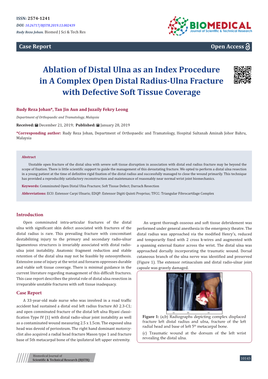 Ablation of Distal Ulna As an Index Procedure in a Complex Open Distal Radius-Ulna Fracture with Defective Soft Tissue Coverage