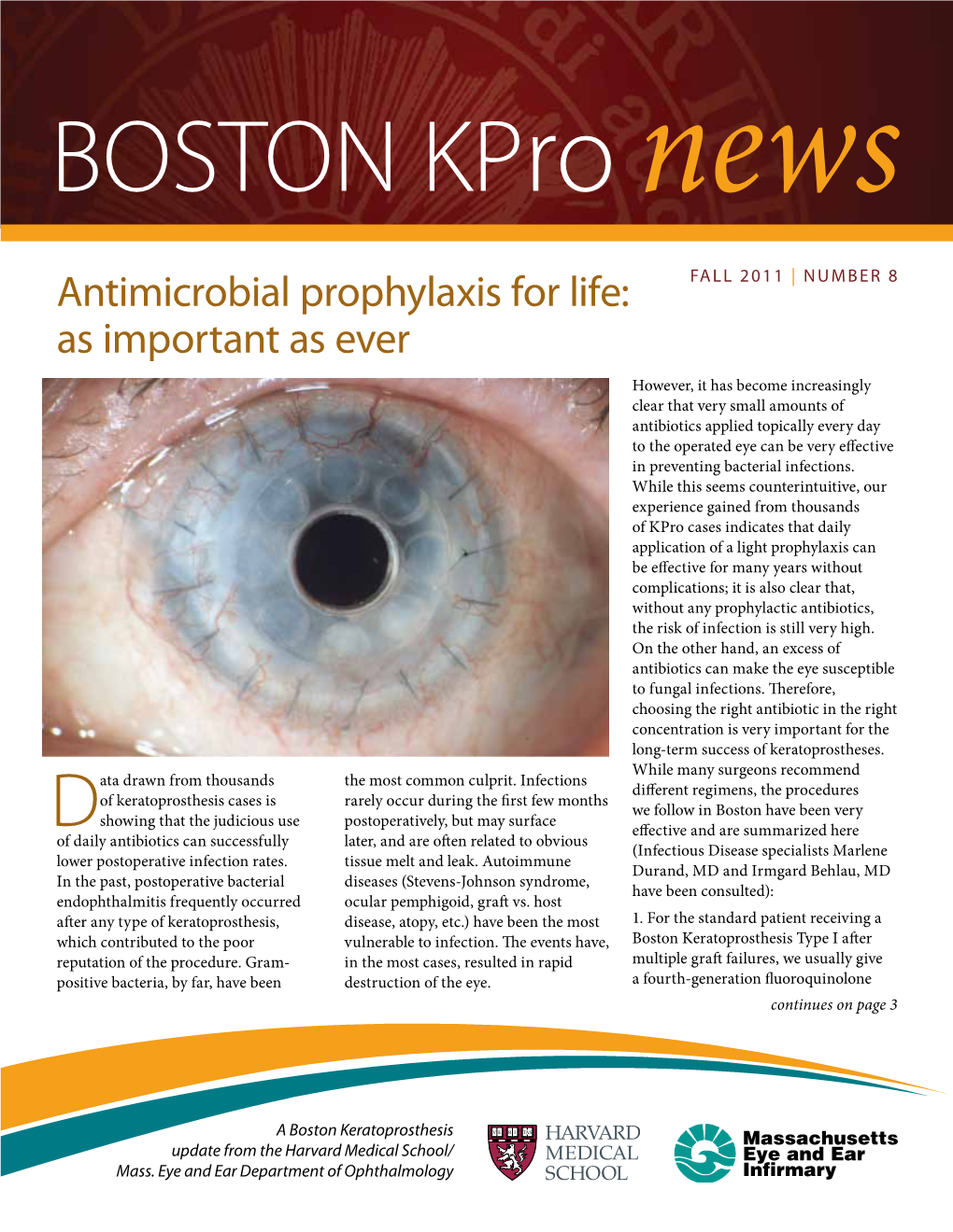 BOSTON Kpro News Antimicrobial Prophylaxis for Life: FALL 2011 | NUMBER 8 As Important As Ever