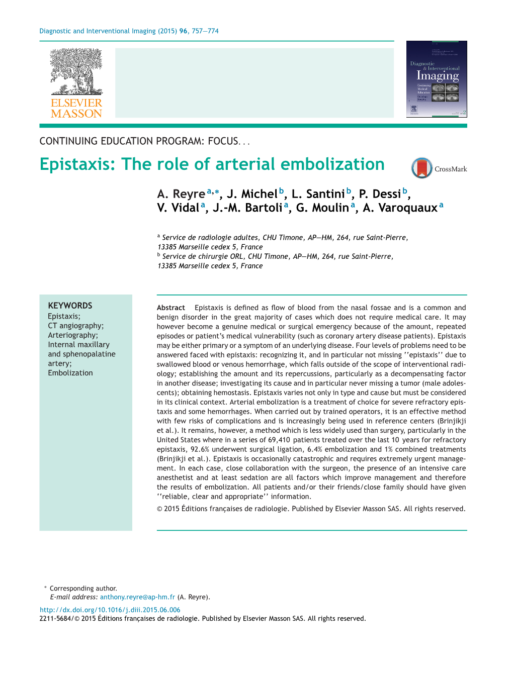 Epistaxis: the Role of Arterial Embolization