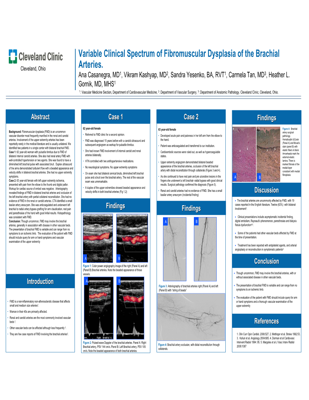 Variable Clinical Spectrum of Fibromuscular Dysplasia of the Brachial Arteries