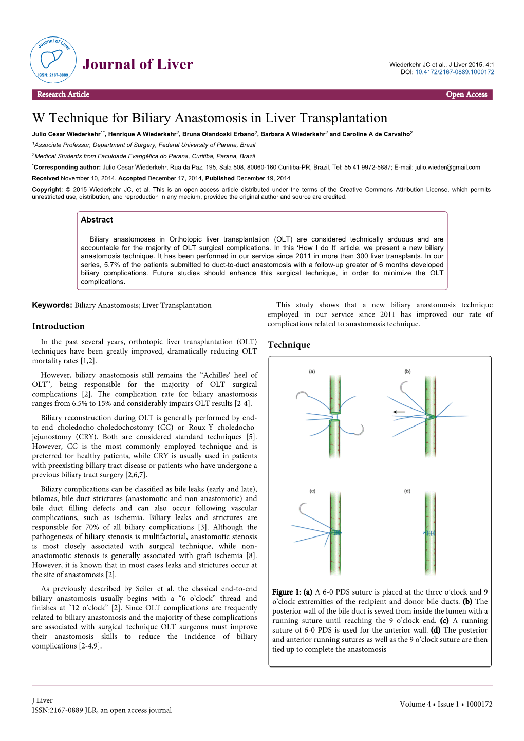 W Technique for Biliary Anastomosis in Liver Transplantation