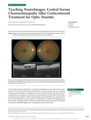 Teaching Neuroimages: Central Serous Chorioretinopathy After Corticosteroid Treatment for Optic Neuritis