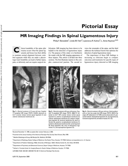 MR Imaging Findings in Spinal Ligamentous Injury Philip F