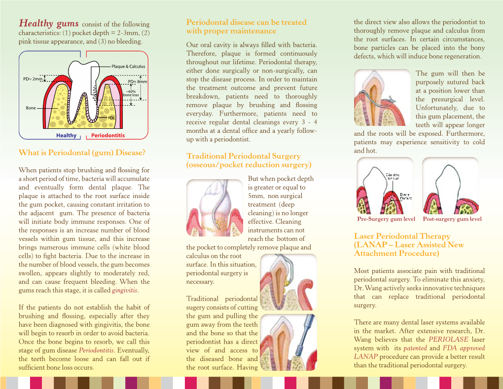 To Download the Laser Periodontal Surgery (LANAP)