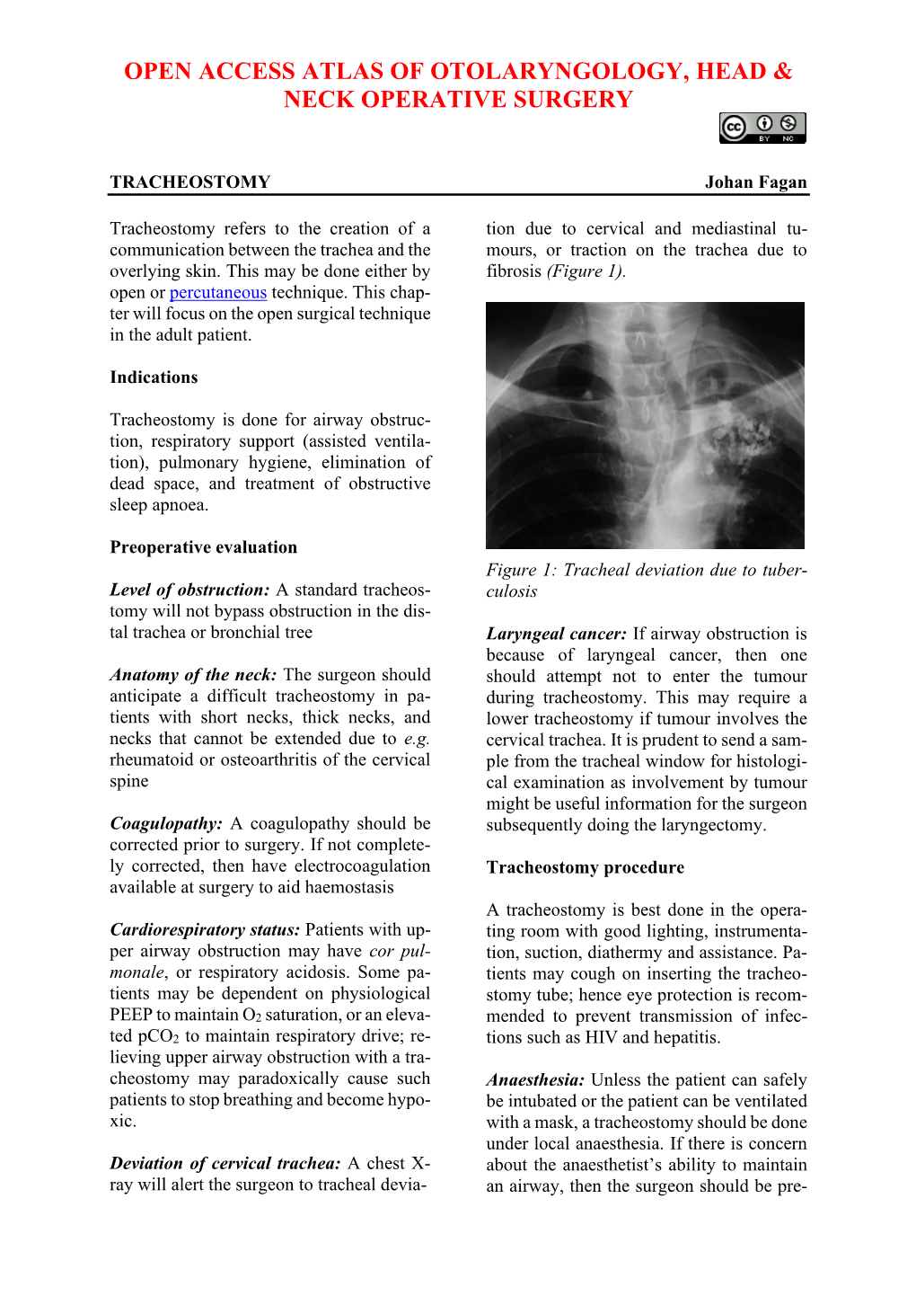 TRACHEOSTOMY Johan Fagan