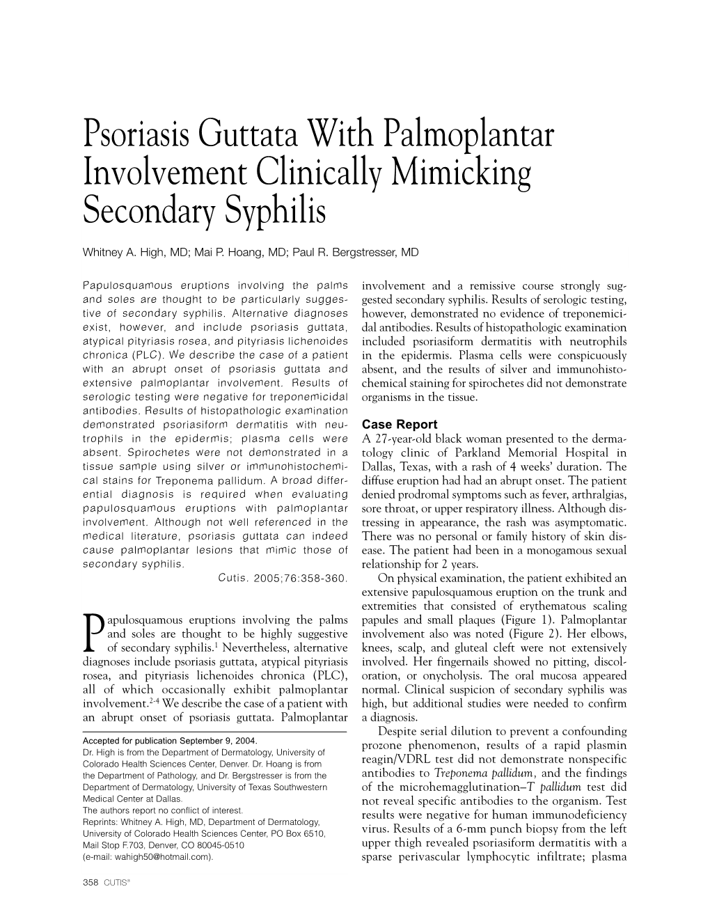 Psoriasis Guttata with Palmoplantar Involvement Clinically Mimicking Secondary Syphilis